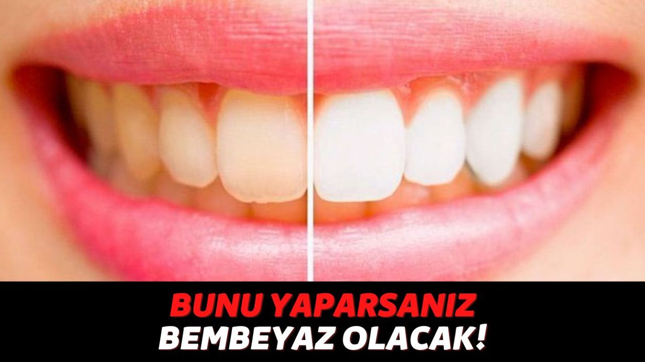 Sararmış ve Beyazlamayan Dişleriniz Varsa 30 Saniye İçinde Bembeyaz Olacak, Dişçilerin Herkesten Sakladığı Sır!