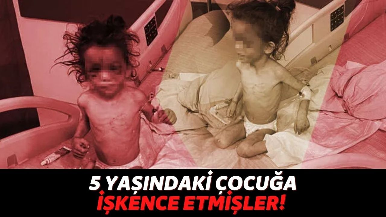 Gaziantep'te 5 Yaşındaki Çocuğa Anne İşkencesi! Günlerce Aç Bırakılmış ve İşkence Edilmiş...