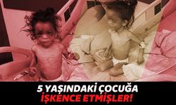 Gaziantep'te 5 Yaşındaki Çocuğa Anne İşkencesi! Günlerce Aç Bırakılmış ve İşkence Edilmiş...